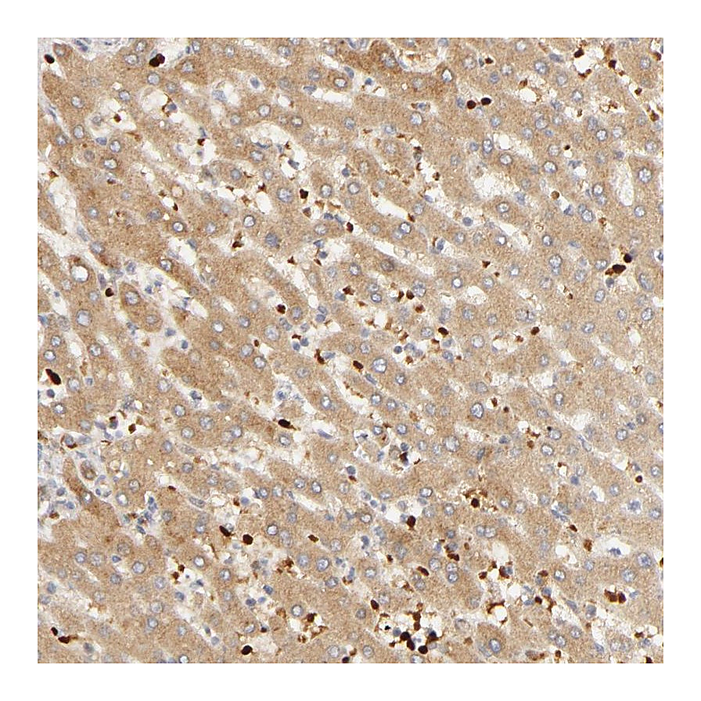 Atlas Antibodies Anti-AGT Antibody