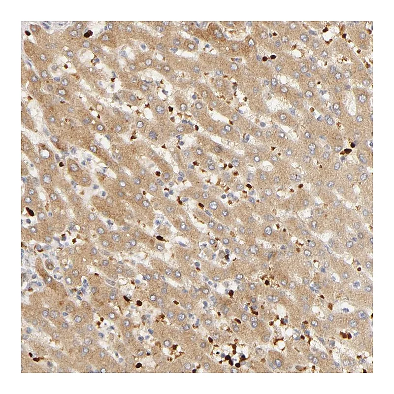 Atlas Antibodies Anti-AGT Antibody