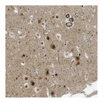 Atlas Antibodies Anti-LRRC8B Antibody