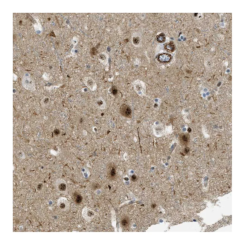 Atlas Antibodies Anti-LRRC8B Antibody