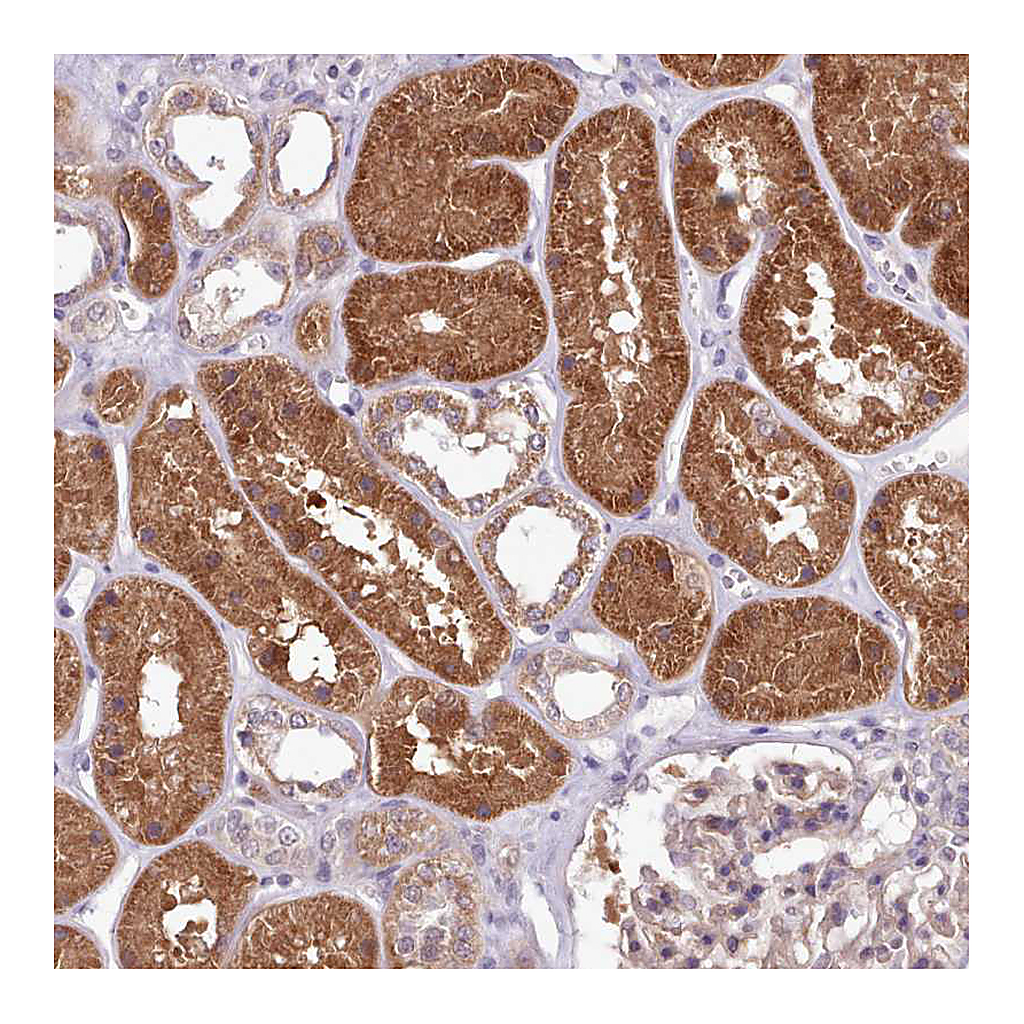 Atlas Antibodies Anti-AHCY Antibody