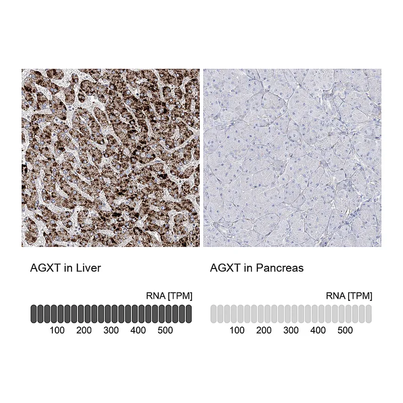 Atlas Antibodies Anti-AGXT Antibody