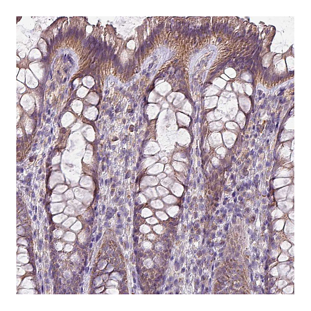 Atlas Antibodies Anti-LRRC9 Antibody