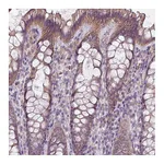 Atlas Antibodies Anti-LRRC9 Antibody