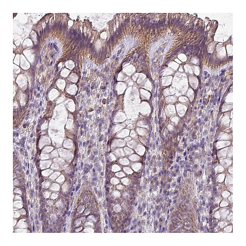 Atlas Antibodies Anti-LRRC9 Antibody