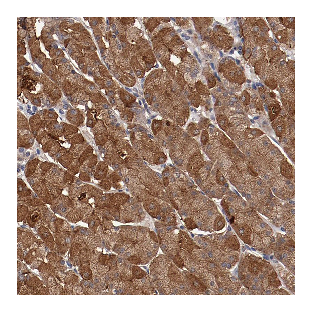 Atlas Antibodies Anti-LRRC75B Antibody