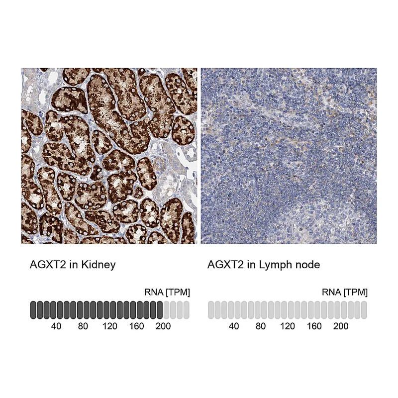 Atlas Antibodies Anti-AGXT2 Antibody