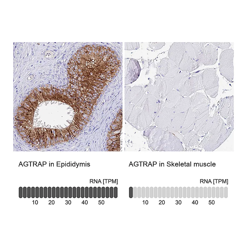 Atlas Antibodies Anti-AGTRAP Antibody