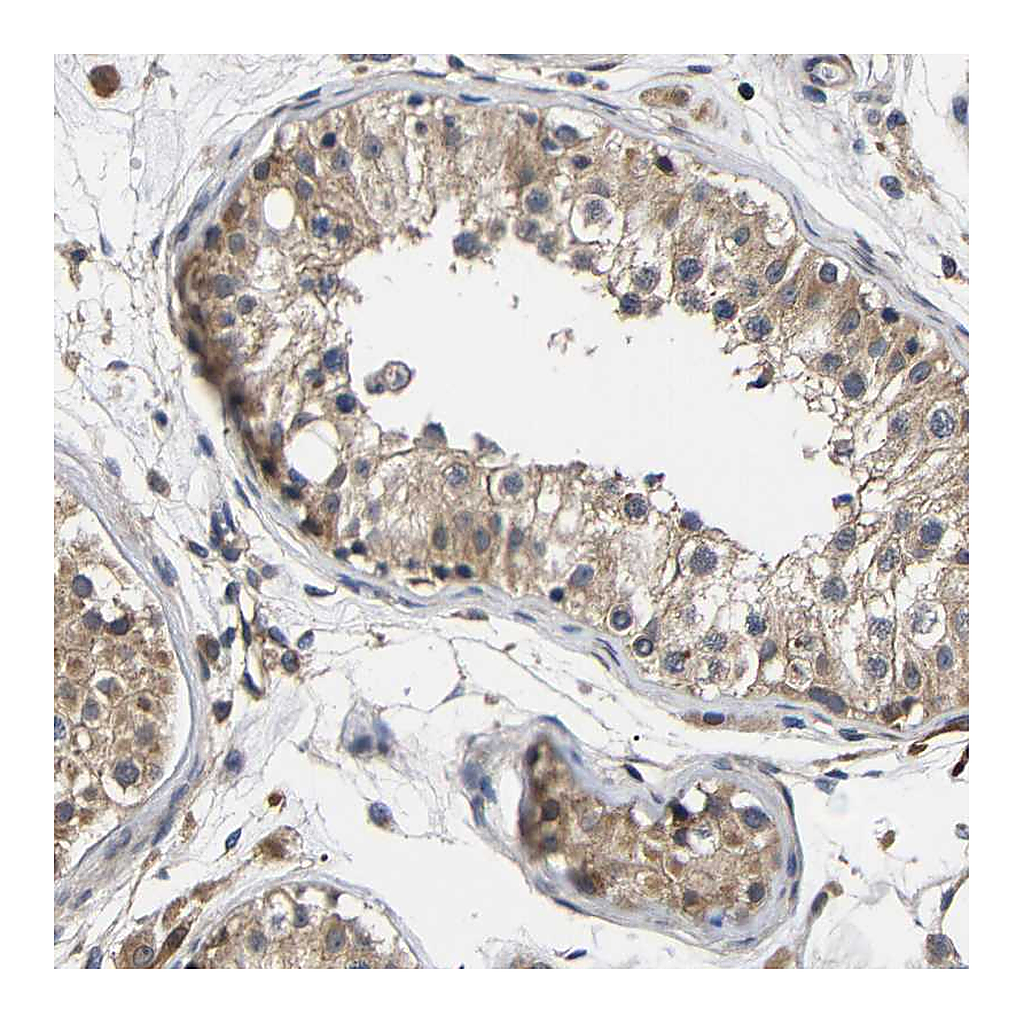 Atlas Antibodies Anti-LRRCC1 Antibody