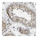 Atlas Antibodies Anti-LRRCC1 Antibody