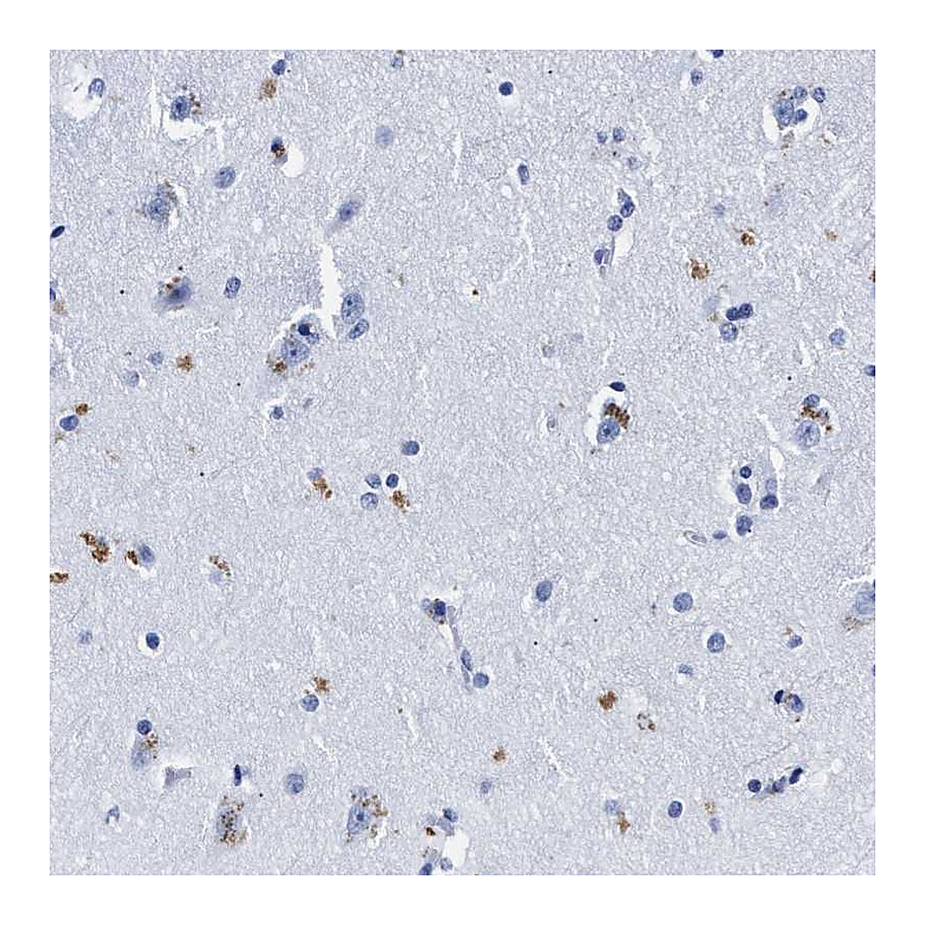 Atlas Antibodies Anti-LRRC8E Antibody