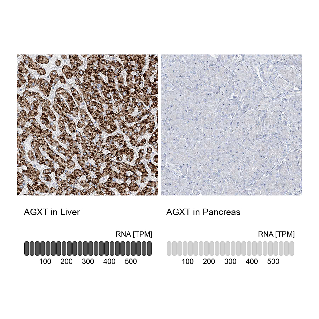 Atlas Antibodies Anti-AGXT Antibody