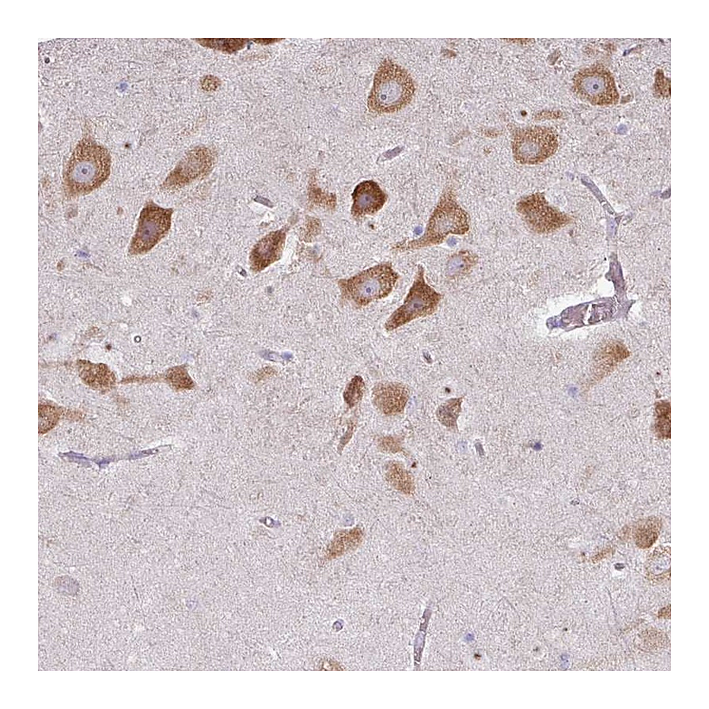 Atlas Antibodies Anti-LRRC9 Antibody