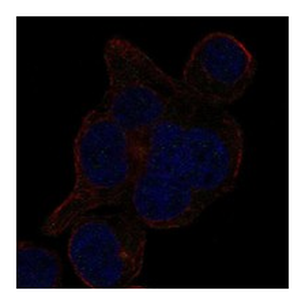 Atlas Antibodies Anti-LRRCC1 Antibody