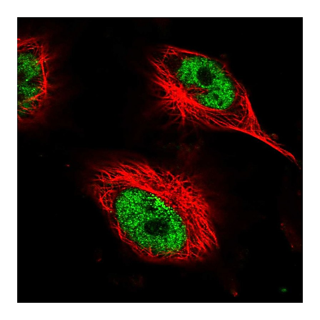 Atlas Antibodies Anti-AHDC1 Antibody