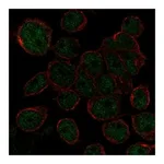 Atlas Antibodies Anti-AHDC1 Antibody