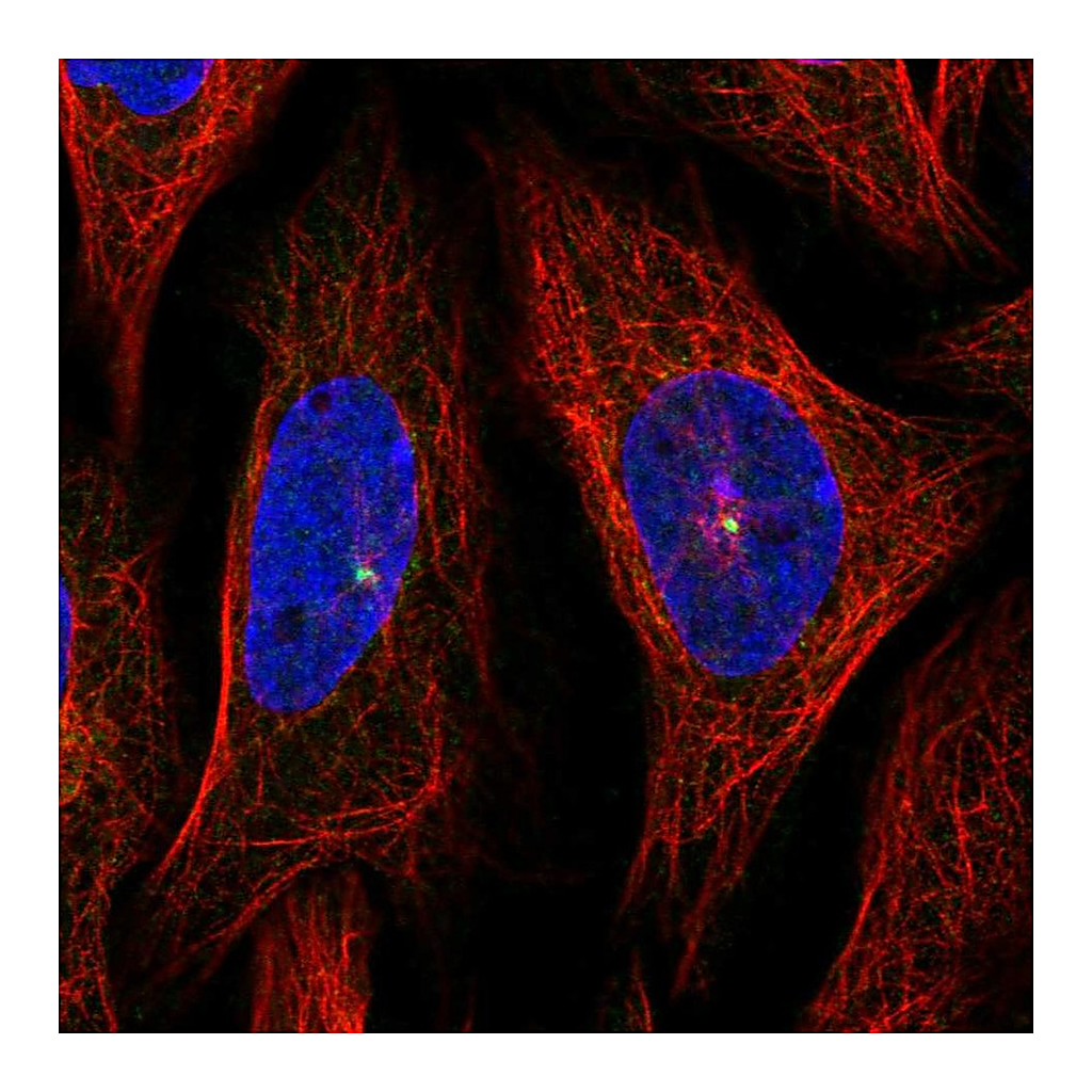 Atlas Antibodies Anti-AHI1 Antibody