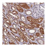 Atlas Antibodies Anti-AHI1 Antibody