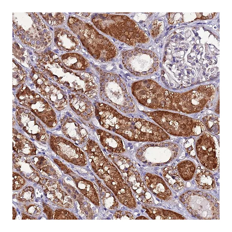 Atlas Antibodies Anti-AHI1 Antibody