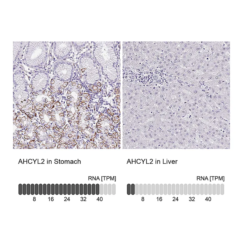 Atlas Antibodies Anti-AHCYL2 Antibody