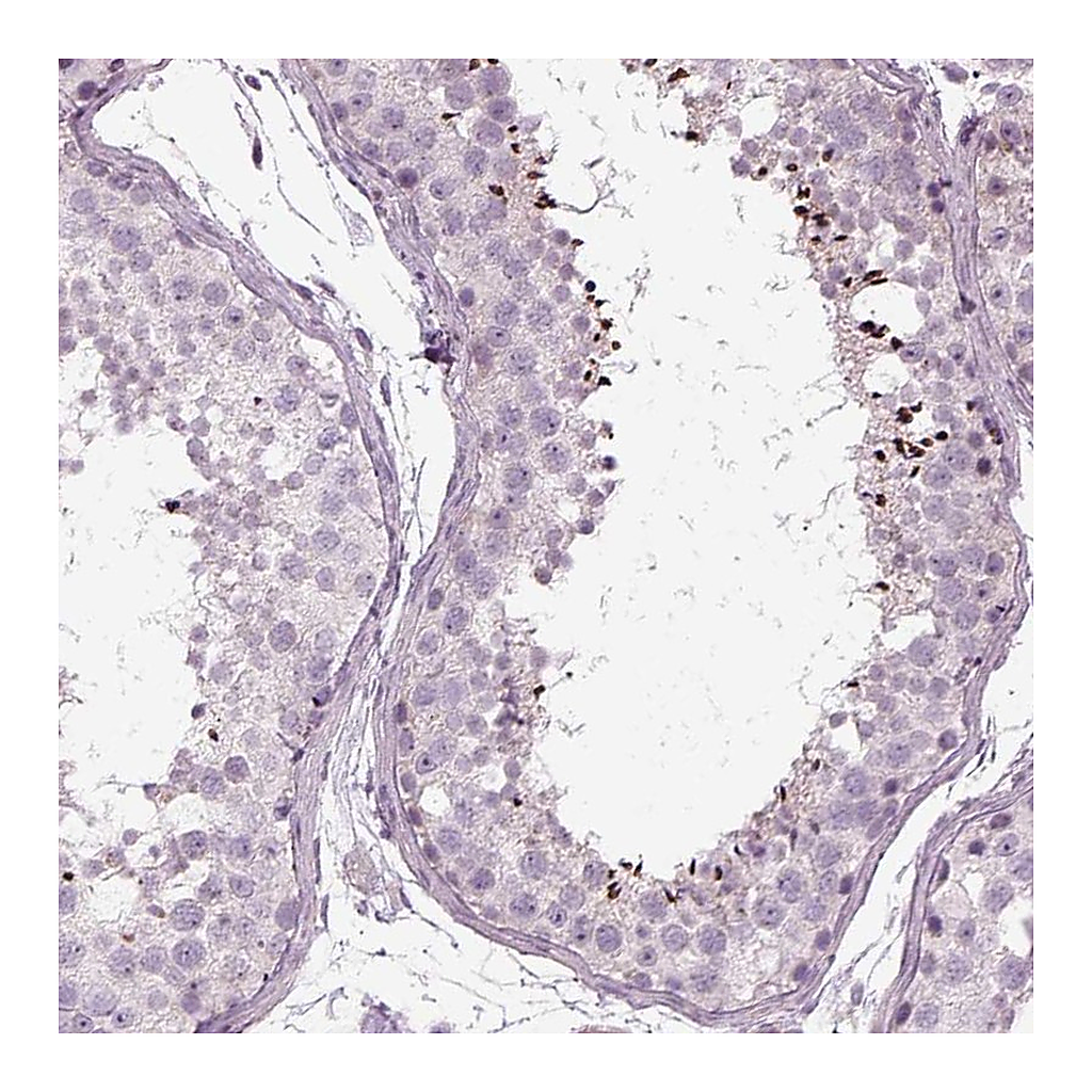 Atlas Antibodies Anti-LRRIQ3 Antibody