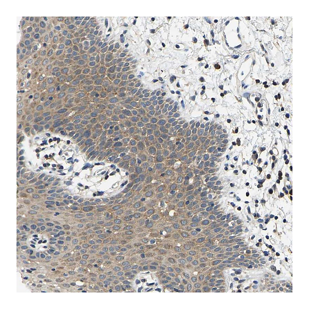 Atlas Antibodies Anti-AHNAK Antibody