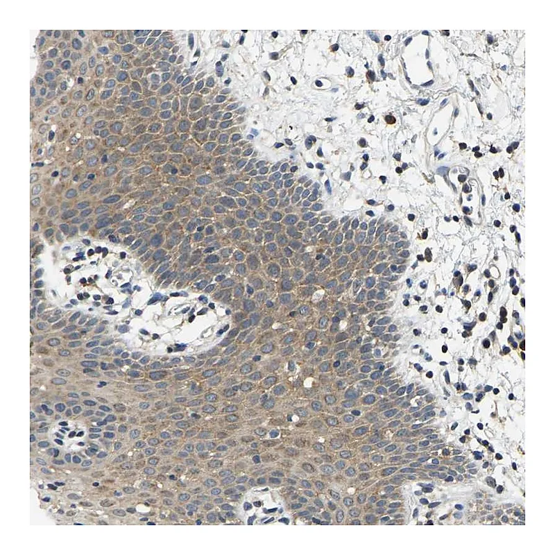 Atlas Antibodies Anti-AHNAK Antibody