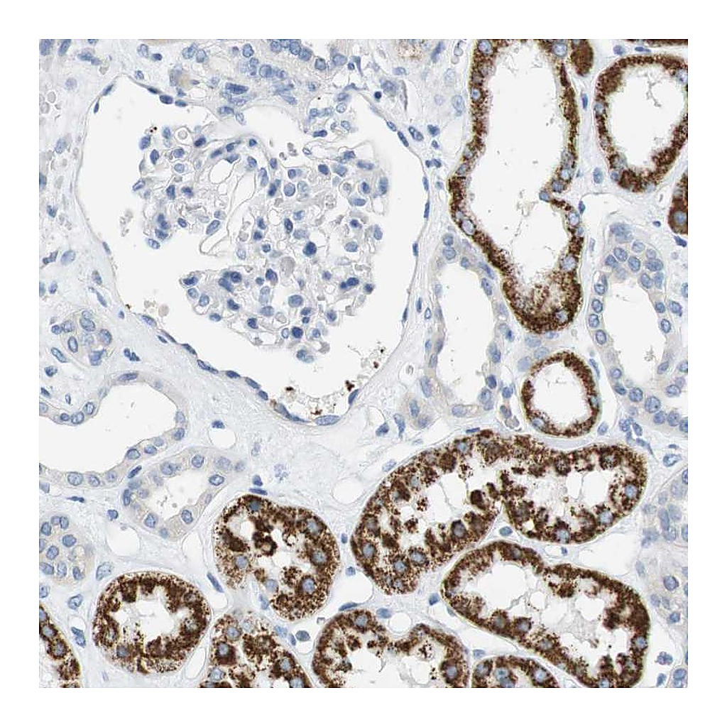 Atlas Antibodies Anti-LRRK2 Antibody