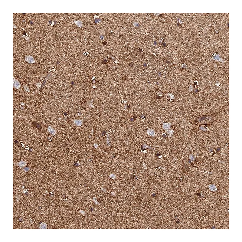 Atlas Antibodies Anti-LRRN3 Antibody