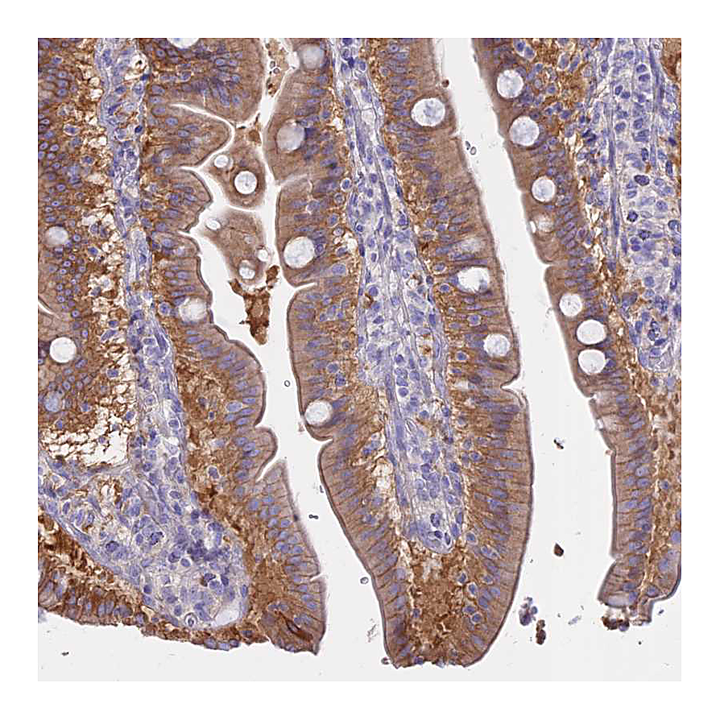 Atlas Antibodies Anti-AHCYL1 Antibody