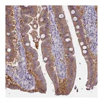 Atlas Antibodies Anti-AHCYL1 Antibody