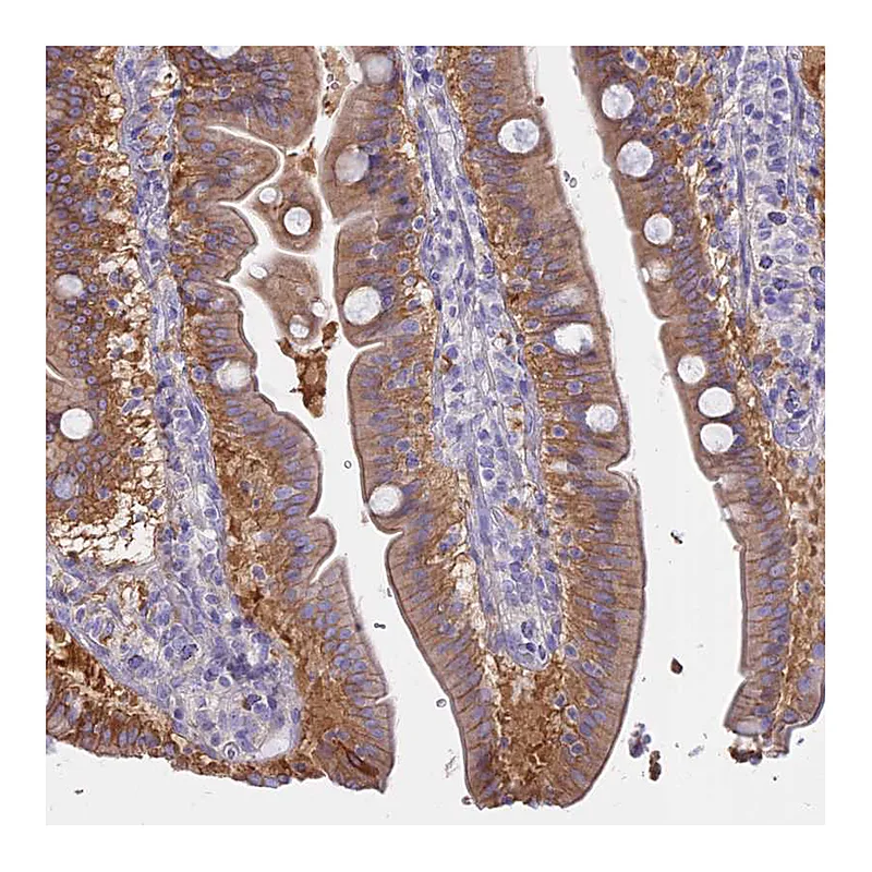 Atlas Antibodies Anti-AHCYL1 Antibody