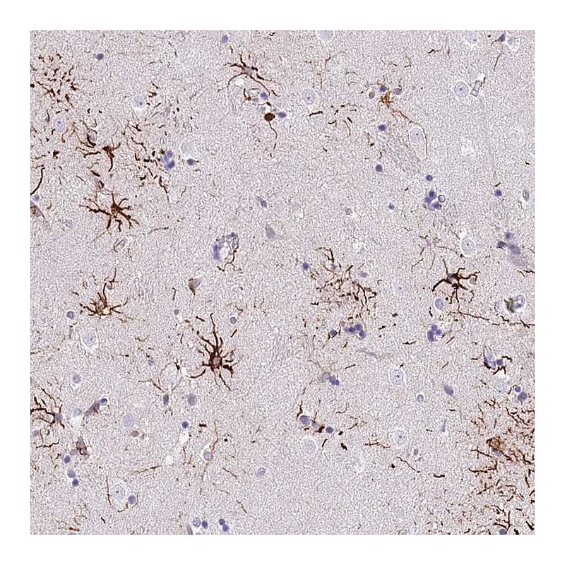Atlas Antibodies Anti-LRRN3 Antibody