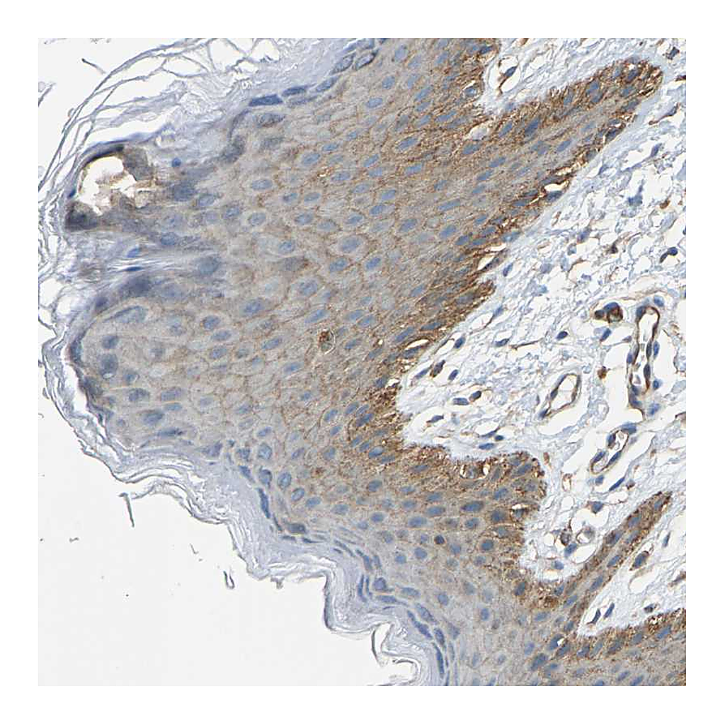 Atlas Antibodies Anti-AHNAK Antibody