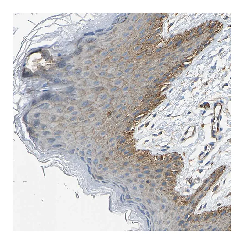 Atlas Antibodies Anti-AHNAK Antibody