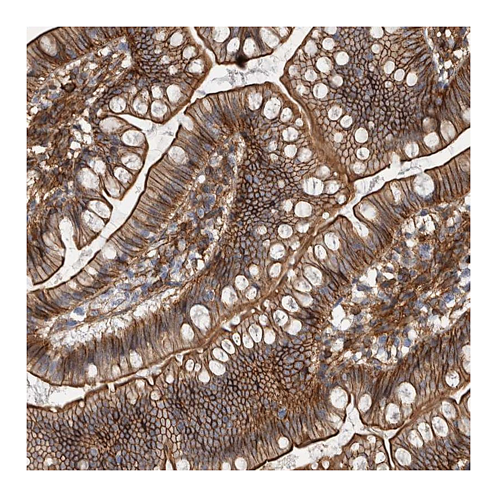 Atlas Antibodies Anti-AHNAK Antibody