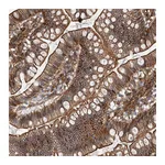 Atlas Antibodies Anti-AHNAK Antibody