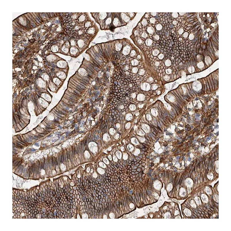 Atlas Antibodies Anti-AHNAK Antibody