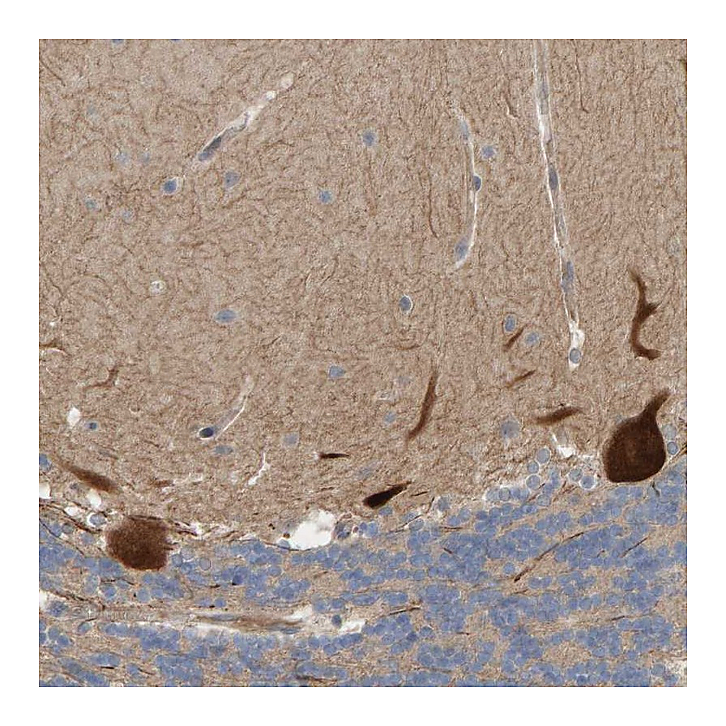 Atlas Antibodies Anti-LRSAM1 Antibody
