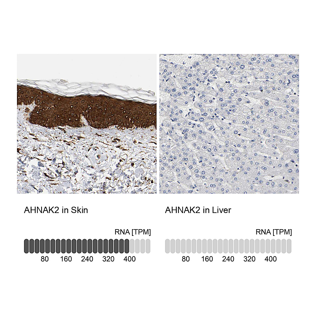 Atlas Antibodies Anti-AHNAK2 Antibody