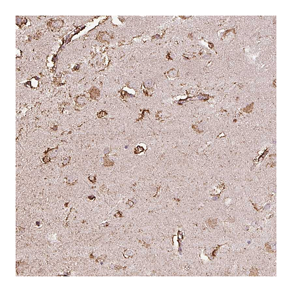 Atlas Antibodies Anti-LRTM2 Antibody