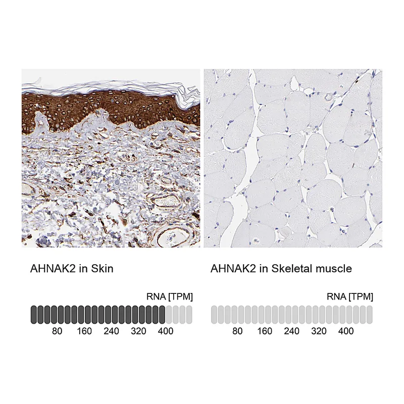 Atlas Antibodies Anti-AHNAK2 Antibody