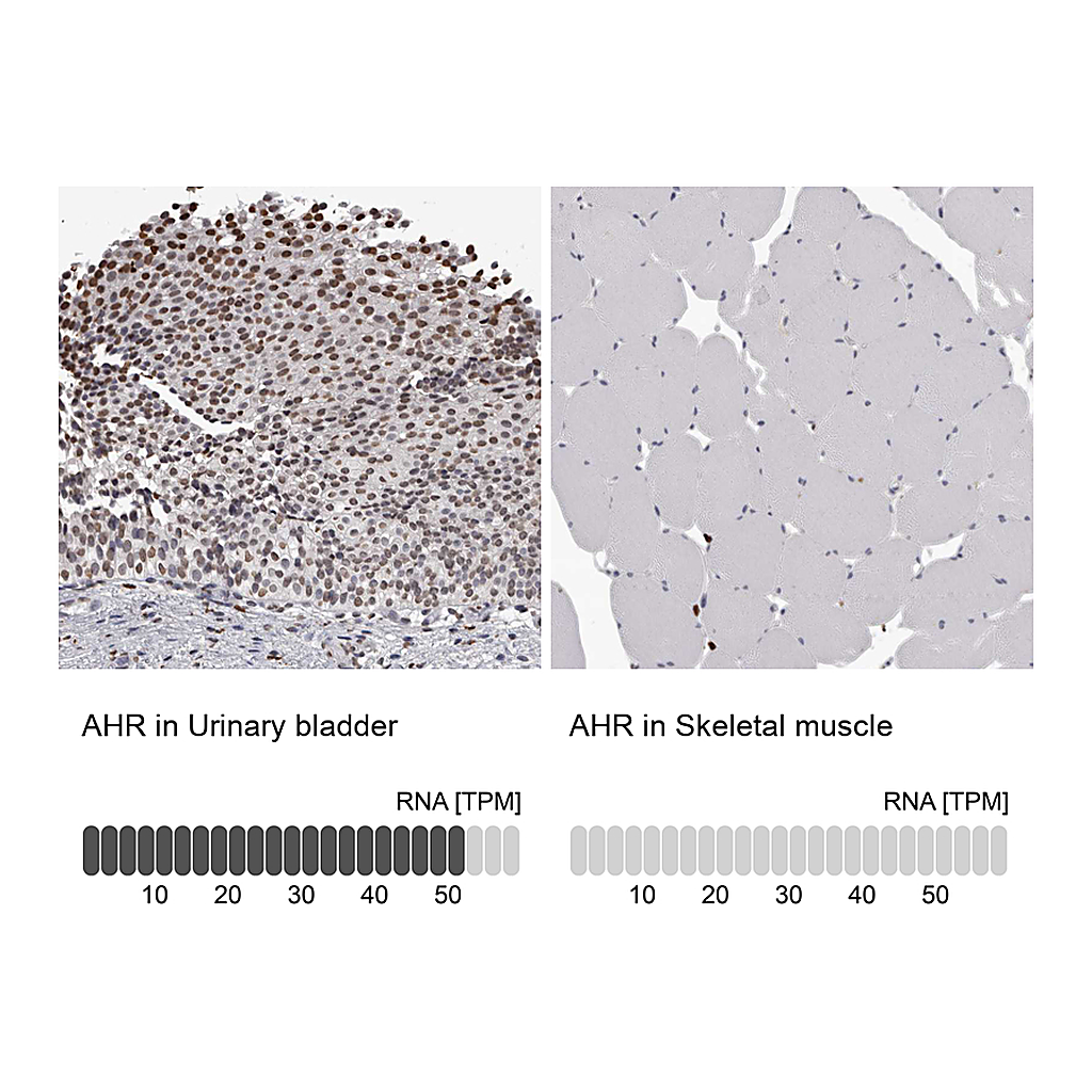 Atlas Antibodies Anti-AHR Antibody