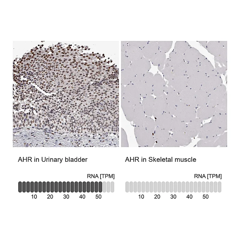 Atlas Antibodies Anti-AHR Antibody