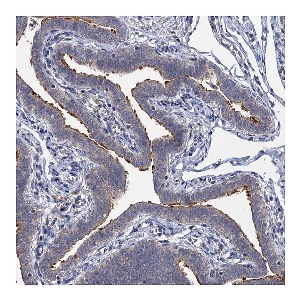 Atlas Antibodies Anti-LRTOMT Antibody