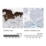 Atlas Antibodies Anti-AHNAK2 Antibody
