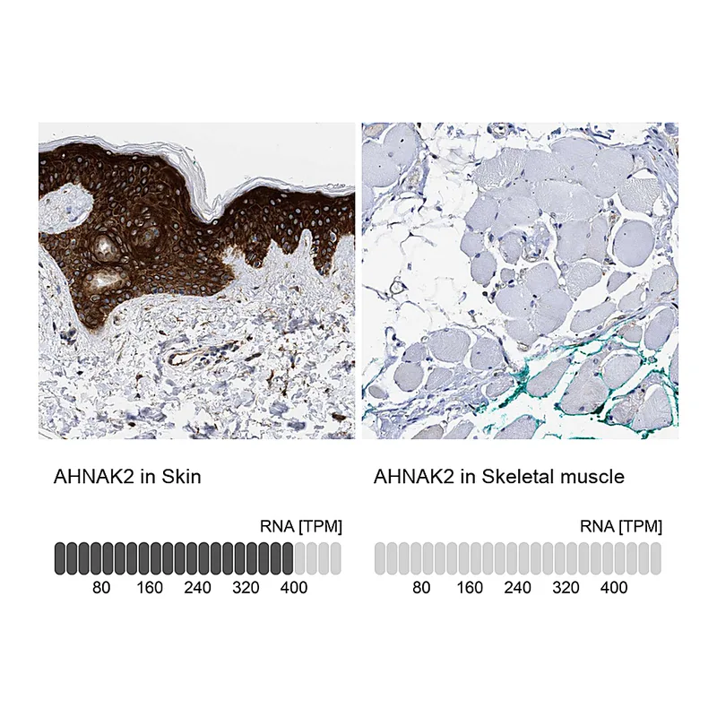 Atlas Antibodies Anti-AHNAK2 Antibody