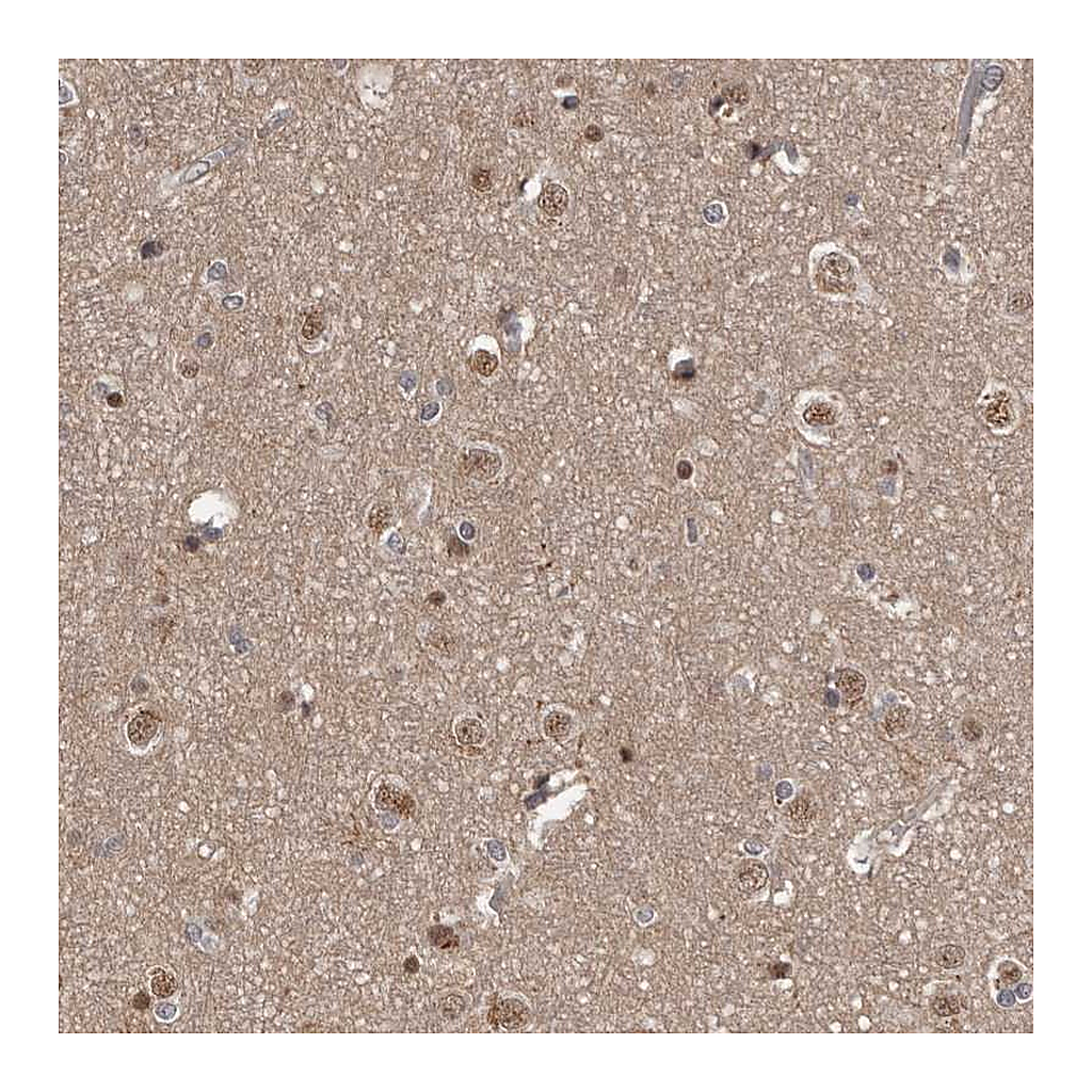 Atlas Antibodies Anti-AHR Antibody