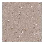 Atlas Antibodies Anti-AHR Antibody