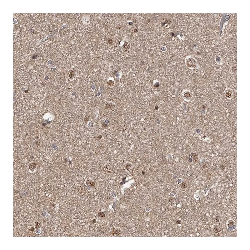 Atlas Antibodies Anti-AHR Antibody